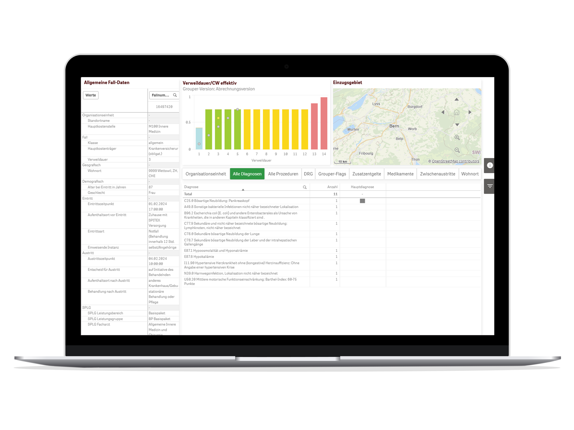 Laptop-DRGlize_CH_Einzelfallanalyse